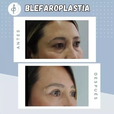Slider image (3) Dr. Felipe Castro Esguerra - Plastic Surgeon in Colombia